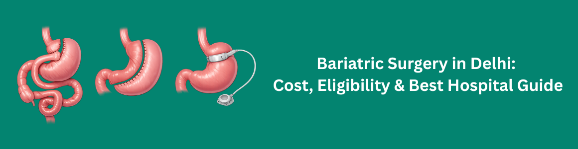 Bariatric Surgery in Delhi: Cost, Eligibility & Best Hospital Guide