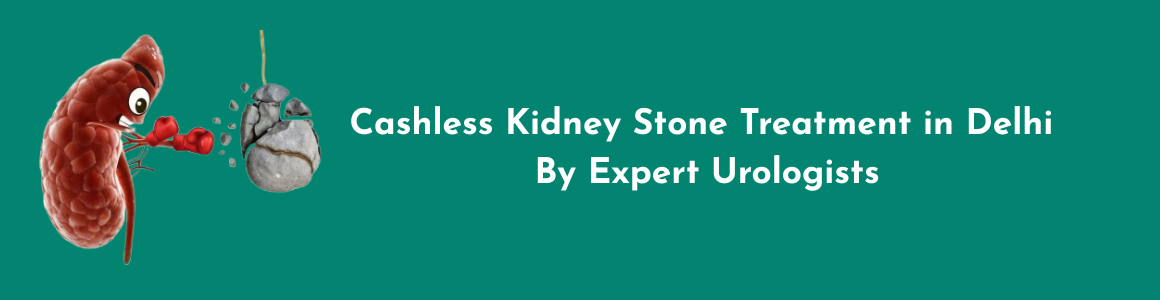 Cashless Kidney Stone Treatment in Delhi by Expert Urologists