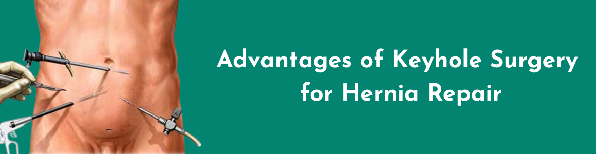Advantages of Keyhole Surgery for Hernia Repair