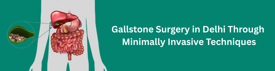 Gallstone Surgery in Delhi Through Minimally Invasive Techniques