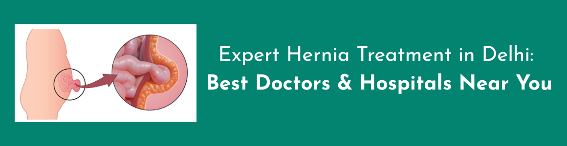 Expert Hernia Treatment in Delhi: Best Doctors & Hospitals Near You