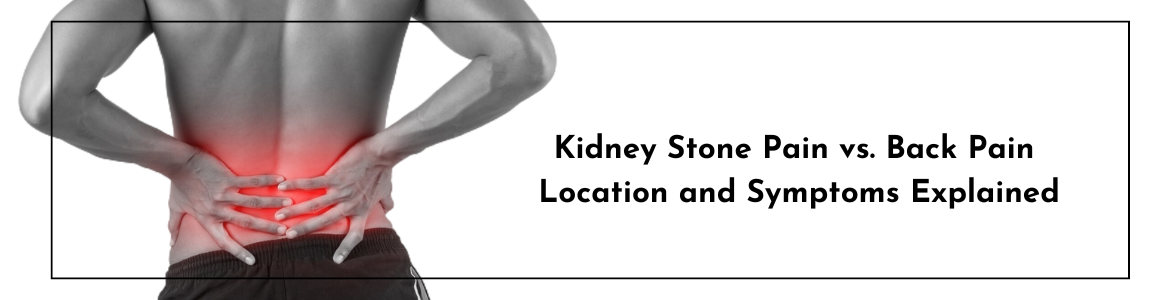 Kidney Stone Pain vs. Back Pain: Location and Symptoms Explained