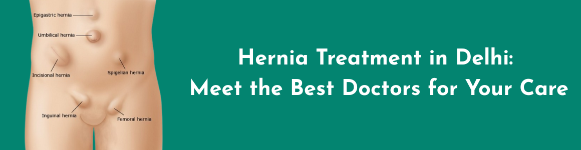 Hernia Treatment in Delhi: Meet the Best Doctors for Your Care