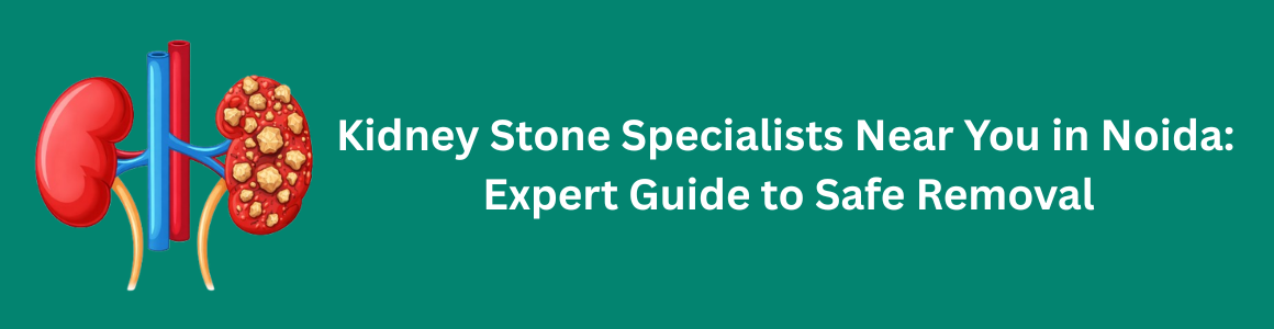 Kidney Stone Specialists Near You in Noida | Expert Guide to Safe Removal