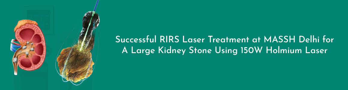 Successful RIRS Laser Treatment at MASSH Delhi for a Large Kidney Stone Using 150W Holmium Laser