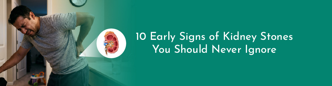 10 Early Signs of Kidney Stones You Should Never Ignore