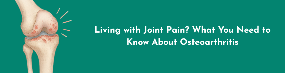 Living with Joint Pain? What You Need to Know About Osteoarthritis