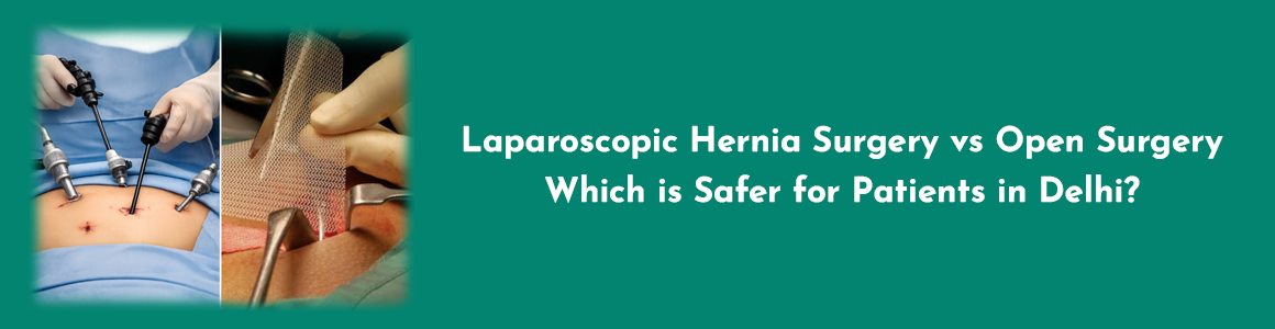 Laparoscopic Hernia Surgery vs Open Surgery – Which is Safer for Patients in Delhi?