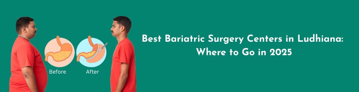 Best Bariatric Surgery Centers in Ludhiana: Where to Go in 2025