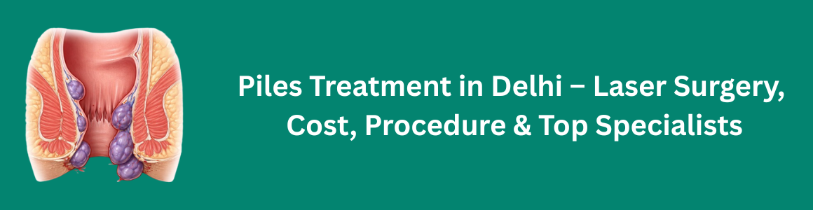 Piles Treatment in Delhi – Laser Surgery, Cost, Procedure & Top Specialists