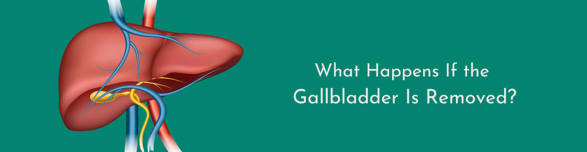 What Happens If the Gallbladder Is Removed?