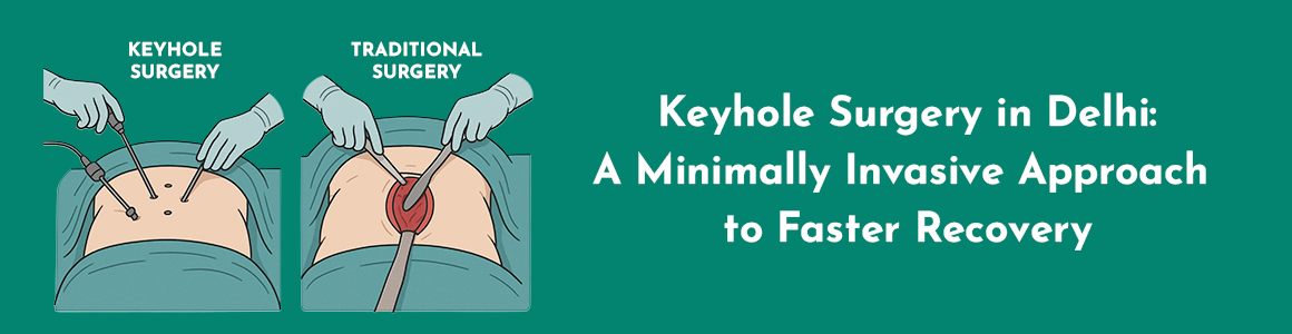 Keyhole Surgery in Delhi: A Minimally Invasive Approach to Faster Recovery