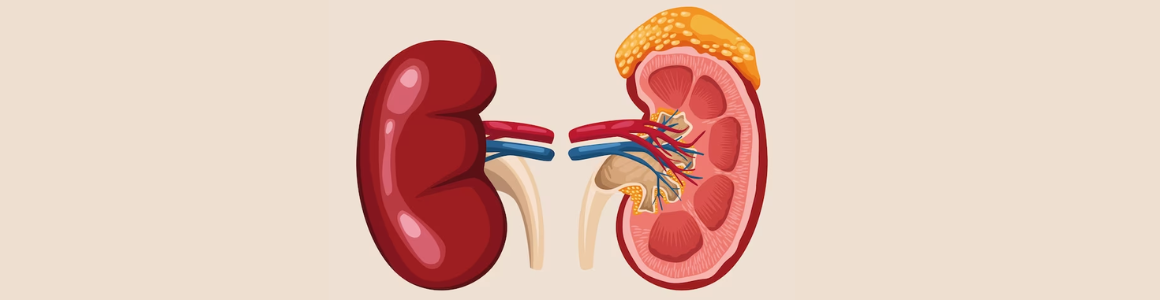 Understanding the Different Types of Kidney Stones and Their Symptoms