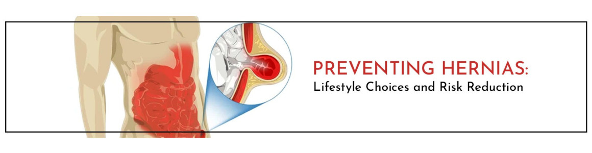 Preventing Hernias: Lifestyle Choices and Risk Reduction