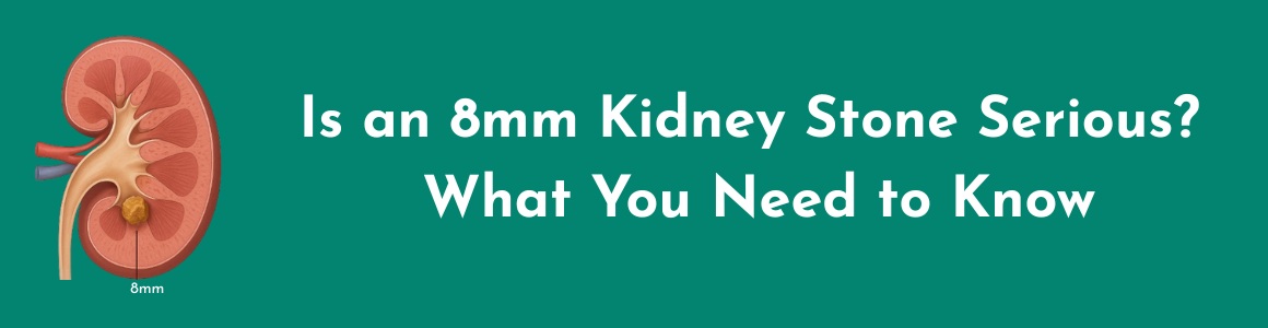 Is an 8mm Kidney Stone Serious? What You Need to Know