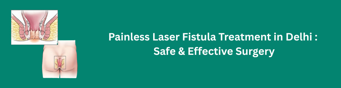 Painless Laser Fistula Treatment in Delhi - Safe & Effective Surgery