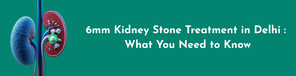 6mm Kidney Stone Treatment in Delhi : What You Need to Know