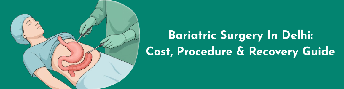 Bariatric Surgery in Delhi – Cost, Procedure & Recovery Guide