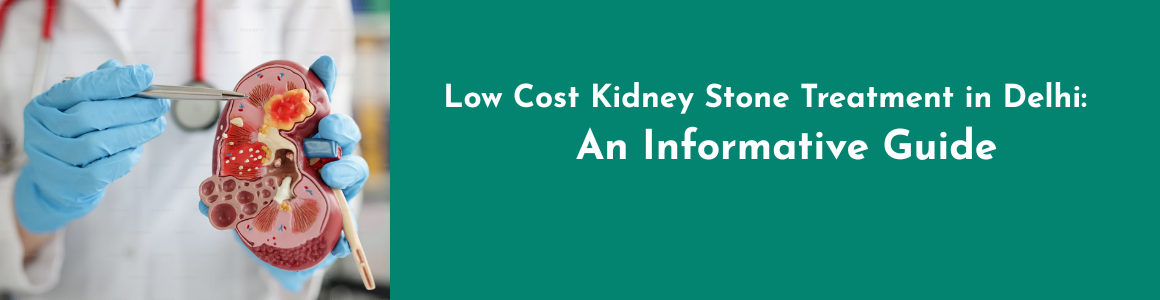 Low Cost Kidney Stone Treatment in Delhi: An Informative Guide