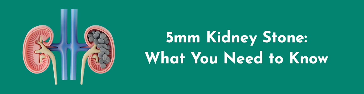 5mm Kidney Stone: What You Need to Know
