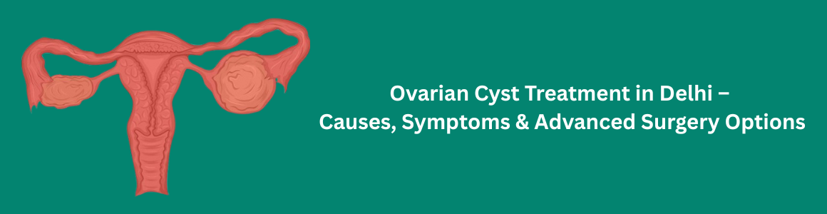 Ovarian Cyst Treatment in Delhi – Causes, Symptoms & Advanced Surgery Options
