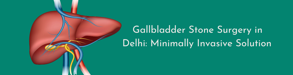 Gallbladder Stone Surgery in Delhi: Minimally Invasive Solution