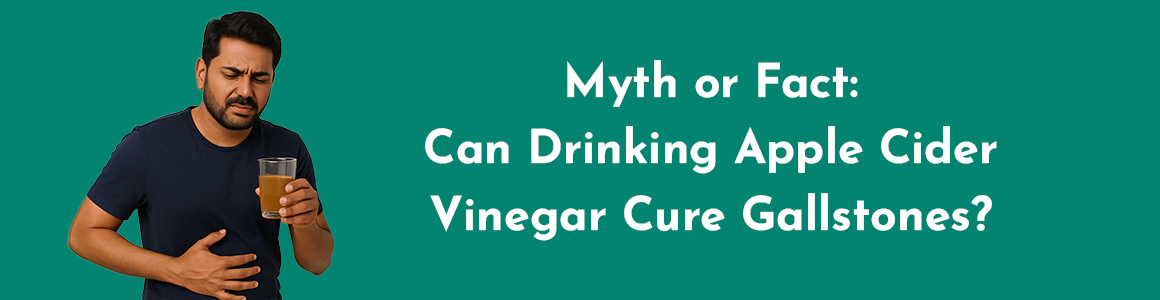 Myth or Fact: Can Drinking Apple Cider Vinegar Cure Gallstones?