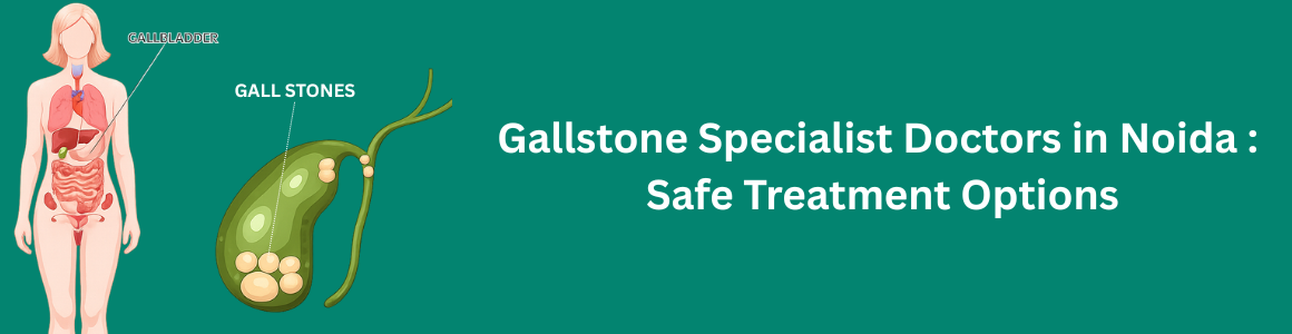Gallstone Specialist Doctors in Noida | Safe Treatment Options