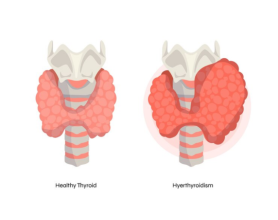 Thyroid Health: Thyroid Disorders and Thyroid Functions