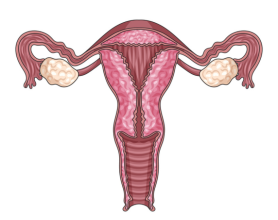 What is Fibroid in the Uterus: Causes and Symptoms