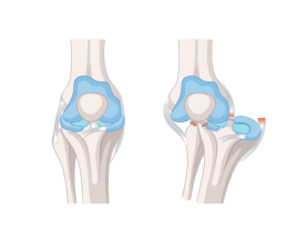 Trusted Orthopaedic Surgeons for Knee & Hip Replacement in Ludhiana, Punjab