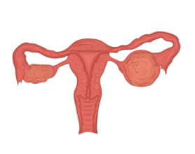 Ovarian Cyst Treatment in Delhi – Causes, Symptoms & Advanced Surgery Options