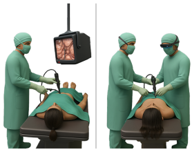 Why 3D Laparoscopic Surgery is Revolutionizing Treatment in Delhi Hospitals