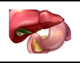 Best Gallbladder Stone Hospitals in Delhi: Finding the Right Care