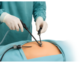 Laparoscopic Surgeons in South Delhi: Common Conditions, Treatments Choose the Right Specialist