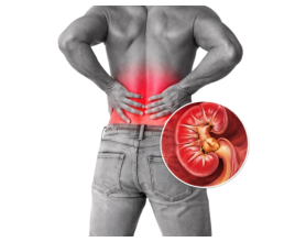 Laser Treatment for Kidney Stones in Noida: Cost, Benefits & Recovery