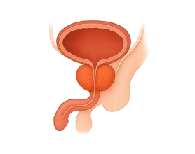 Find the Best Enlarged Prostate Doctor in Delhi for Effective Treatment