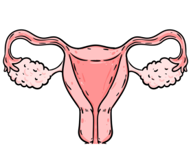 What Happens If Fibroids Go Untreated?
