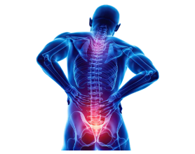 Neck Pain or Spondylitis? How to Treat Spondylitis at Home Naturally