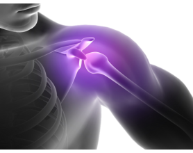 Handling a Dislocated Shoulder: Do’s and Don’ts