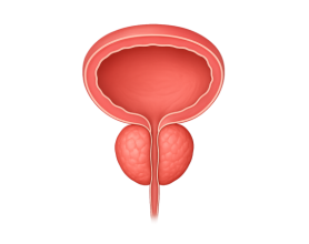 Experienced Enlarged Prostate Doctors in Delhi: What You Need to Know