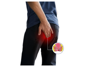 Fistula Treatment in Delhi: Causes, Symptoms & Latest Laser Surgery Options