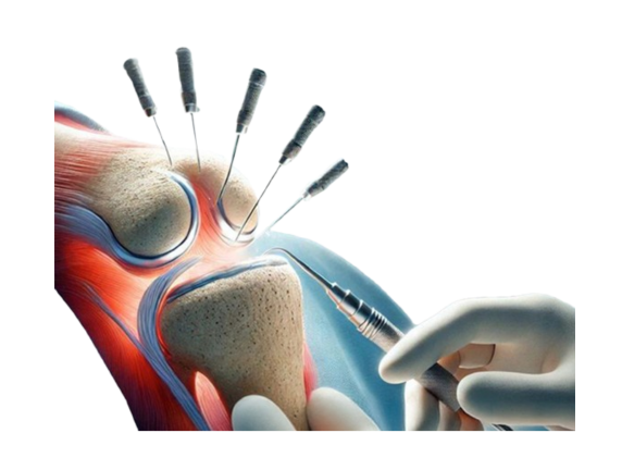 How Modern Orthopedic Surgery Helps You Walk Without Pain Again