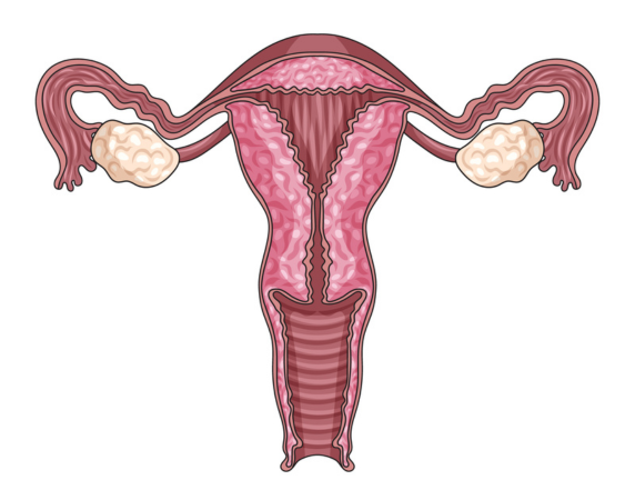 What is Fibroid in the Uterus: Causes and Symptoms