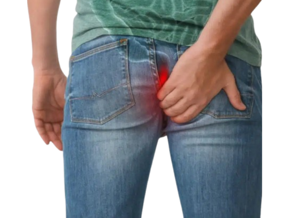 Can Anal Fistula Heal Without Surgery?