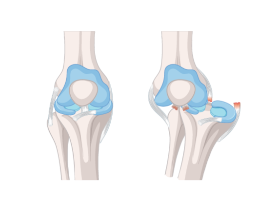 Trusted Orthopaedic Surgeons for Knee & Hip Replacement in Ludhiana, Punjab
