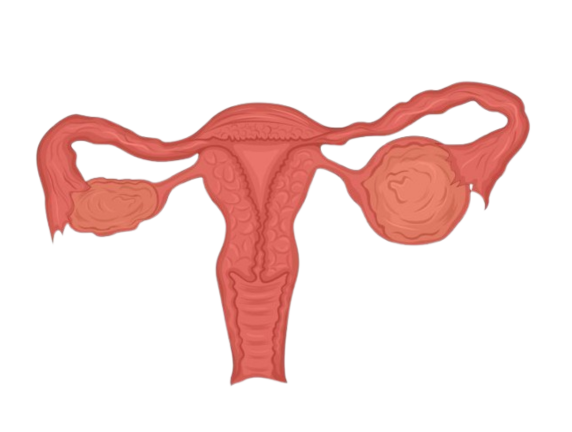 Ovarian Cyst Treatment in Delhi – Causes, Symptoms & Advanced Surgery Options