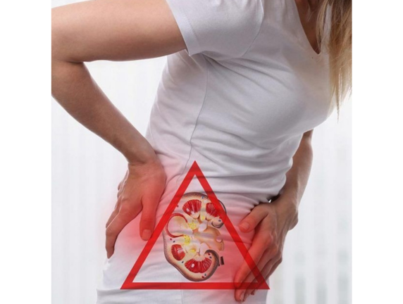 10 Early Signs of Kidney Disease You Shouldn’t Ignore