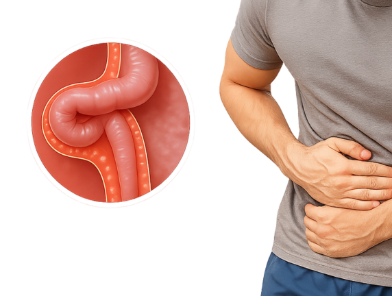 Best Hospital for Hernia Treatment in Delhi – Expert Care & Advanced Surgery