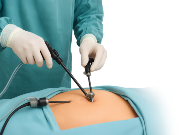 Laparoscopic Surgeons in South Delhi: Common Conditions, Treatments Choose the Right Specialist